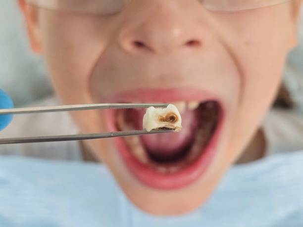 Best Pediatric Emergency Dentist in Gumlog, GA